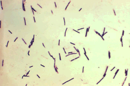 TREATMENT CLOSTRIDIUM PERFRINGENS CAT visual data 8